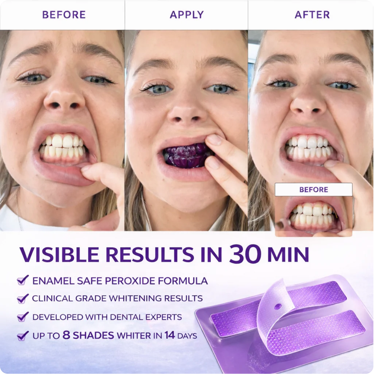 Purple Teeth Whitening Strips